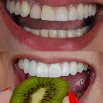 Dentista Porto Alegre | Clínica Dental Center