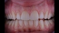 Dentista Porto Alegre | Clínica Dental Center