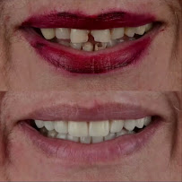 Dentista Porto Alegre | Clínica Dental Center