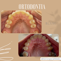 Blanc Especialidades Odontológicas