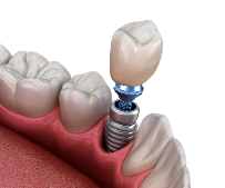 Dental Arte Andradas