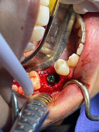 BIXÖNT DENTAL