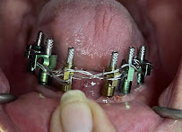 BIXÖNT DENTAL