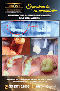 Bixönt Dental Clinic in Guadalajara