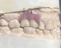 BIXÖNT DENTAL