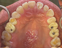 BIXÖNT DENTAL