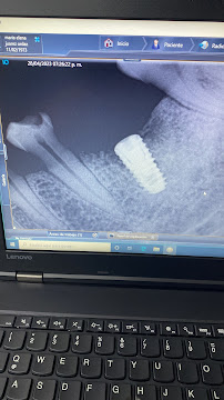 BIXÖNT DENTAL
