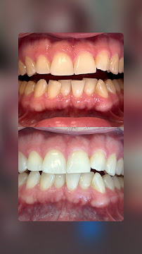 Dra Jéssica Soares | Consulta | Bruxismo | Facetas | Clareamento | Restauração | Revisão | Periodontia DENTISTA PORTO ALEGRE