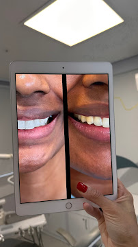 Dra Jéssica Soares | Consulta | Bruxismo | Facetas | Clareamento | Restauração | Revisão | Periodontia DENTISTA PORTO ALEGRE