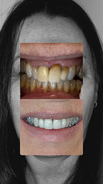 Dra Jéssica Soares | Consulta | Bruxismo | Facetas | Clareamento | Restauração | Revisão | Periodontia DENTISTA PORTO ALEGRE