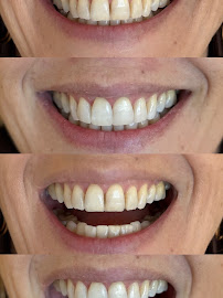Dra Jéssica Soares | Consulta | Bruxismo | Facetas | Clareamento | Restauração | Revisão | Periodontia DENTISTA PORTO ALEGRE