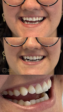Dra Jéssica Soares | Consulta | Bruxismo | Facetas | Clareamento | Restauração | Revisão | Periodontia DENTISTA PORTO ALEGRE