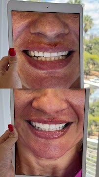 Dra Jéssica Soares | Consulta | Bruxismo | Facetas | Clareamento | Restauração | Revisão | Periodontia DENTISTA PORTO ALEGRE