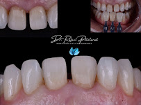 Dr. Rafael Pocztaruk - Implante Dentário Porto Alegre l Lentes em Resina Premium l Faceta Porcelana l Protocolo de Implante