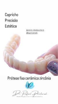 Dr. Rafael Pocztaruk - Implante Dentário Porto Alegre l Lentes em Resina Premium l Faceta Porcelana l Protocolo de Implante