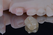 Dr. Rafael Pocztaruk - Implante Dentário Porto Alegre l Lentes em Resina Premium l Faceta Porcelana l Protocolo de Implante