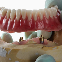 Dr. Rafael Pocztaruk - Implante Dentário Porto Alegre l Lentes em Resina Premium l Faceta Porcelana l Protocolo de Implante