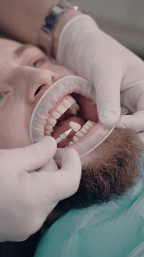 Dr. Rafael Pocztaruk - Implante Dentário Porto Alegre l Lentes em Resina Premium l Faceta Porcelana l Protocolo de Implante