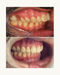 Vitah Odontologia - Dra. Márcia de Fernandes | Ortodontia Invisalign Top Doctor em Porto Alegre