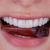 Dentista Sorridere Porto Alegre