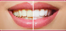 Dentista Sorridere Porto Alegre