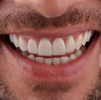Clínica Reis Odontologia Especializada - EPAO 4779