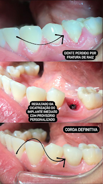 WK•R ODONTOLOGIA | Dentista Porto Alegre | Lente de Contato Dental / Implante Dentário / Invisalign / Zona Norte Porto Alegre