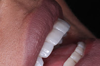 WK•R ODONTOLOGIA | Dentista Porto Alegre | Lente de Contato Dental / Implante Dentário / Invisalign / Zona Norte Porto Alegre
