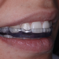 WK•R ODONTOLOGIA | Dentista Porto Alegre | Lente de Contato Dental / Implante Dentário / Invisalign / Zona Norte Porto Alegre
