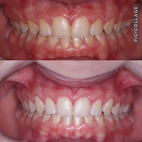 WK•R ODONTOLOGIA | Dentista Porto Alegre | Lente de Contato Dental / Implante Dentário / Invisalign / Zona Norte Porto Alegre