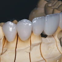WK•R ODONTOLOGIA | Dentista Porto Alegre | Lente de Contato Dental / Implante Dentário / Invisalign / Zona Norte Porto Alegre