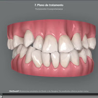 WK•R ODONTOLOGIA | Dentista Porto Alegre | Lente de Contato Dental / Implante Dentário / Invisalign / Zona Norte Porto Alegre