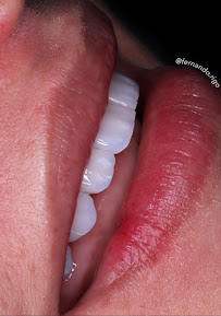 WK•R ODONTOLOGIA | Dentista Porto Alegre | Lente de Contato Dental / Implante Dentário / Invisalign / Zona Norte Porto Alegre