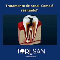 Toresan Odontologia: implante dentário, ortodontia, clareamento dental, lente de contato dental, periodontia, endodontia
