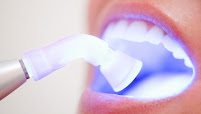 Toresan Odontologia: implante dentário, ortodontia, clareamento dental, lente de contato dental, periodontia, endodontia