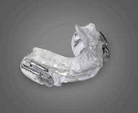 Toresan Odontologia: implante dentário, ortodontia, clareamento dental, lente de contato dental, periodontia, endodontia