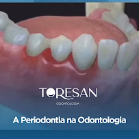 Toresan Odontologia: implante dentário, ortodontia, clareamento dental, lente de contato dental, periodontia, endodontia