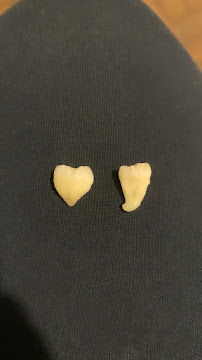 Dr. Luciano Engelmann Morais - Cirurgia Bucomaxilofacial