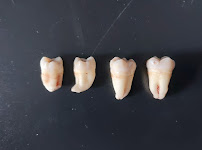 Dr. Luciano Engelmann Morais - Cirurgia Bucomaxilofacial