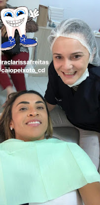 Dra. Clarissa Freitas - Faceta de Porcelana em Campinas