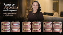 Dra. Clarissa Freitas - Faceta de Porcelana em Campinas