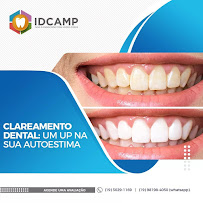 Dra. Clarissa Freitas - Faceta de Porcelana em Campinas