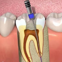 Odontologia Vulcano Urgência Campinas