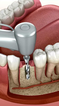 Odontologia Vulcano Urgência Campinas