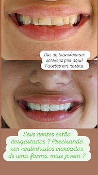 Odontologia Vulcano Urgência Campinas