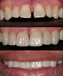 Guno Dental