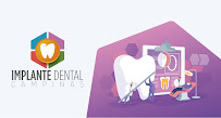 Implante Dental Campinas