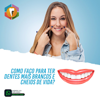 Implante Dental Campinas