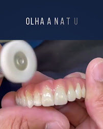 Implante Dental Campinas
