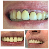 Implante Dental Campinas